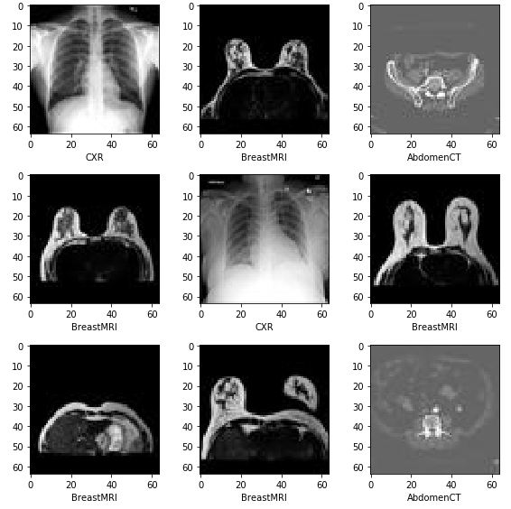 Tumor Classification